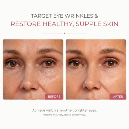 Collagen Eye Patches