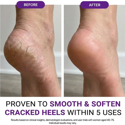 Magnesium legs butter