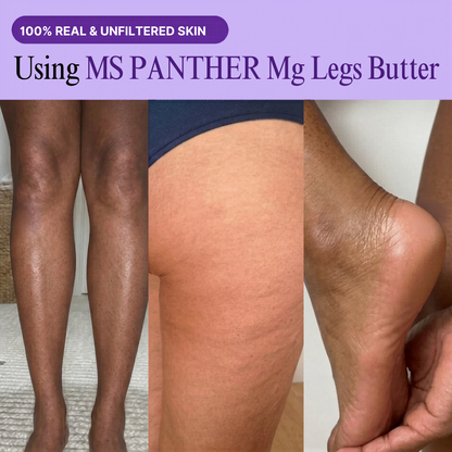Magnesium legs butter
