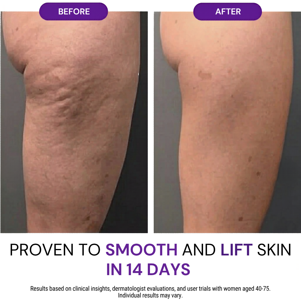 Magnesium legs butter