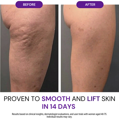 Magnesium legs butter